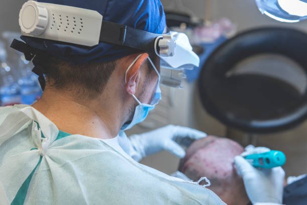 Delhi Derma Clinic Patchy Beard Treatment Delhi option 2