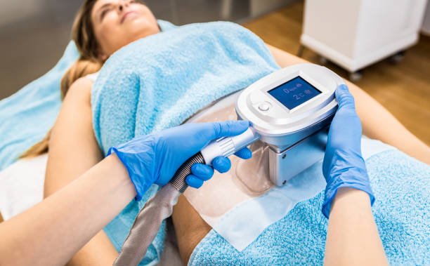Delhi Derma Clinic coolsculpting treatment